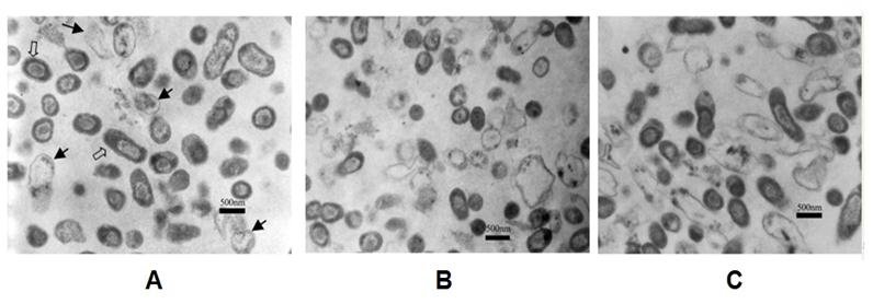 Micrografía de Bordetella pertussis