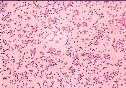 Micrografía de Bordetella pertussis